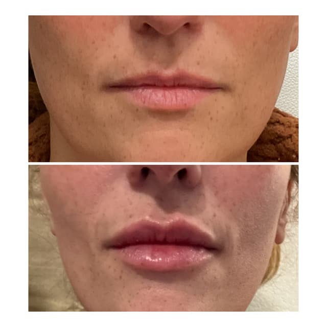 Aesthetic Advantage at The Nice Needle and Spa in Prosper, TX